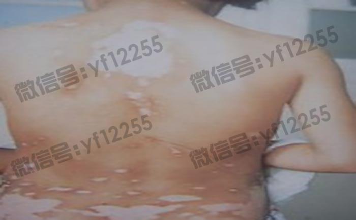 武汉环亚中医白癜风医院