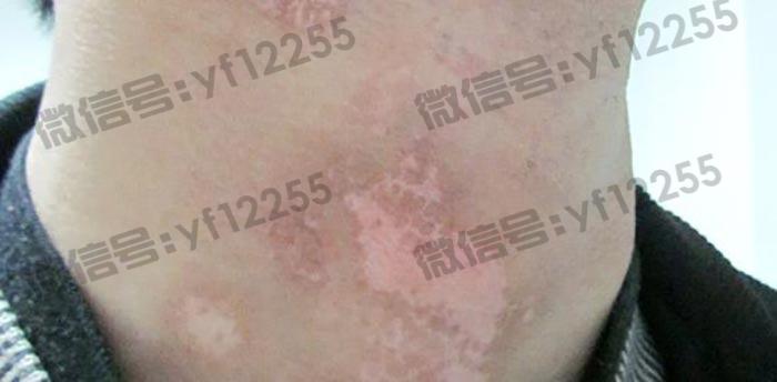 武汉环亚中医白癜风医院