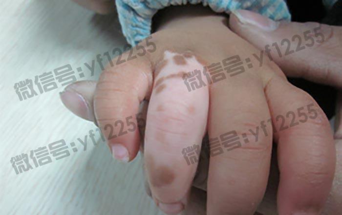 武汉环亚中医白癜风医院