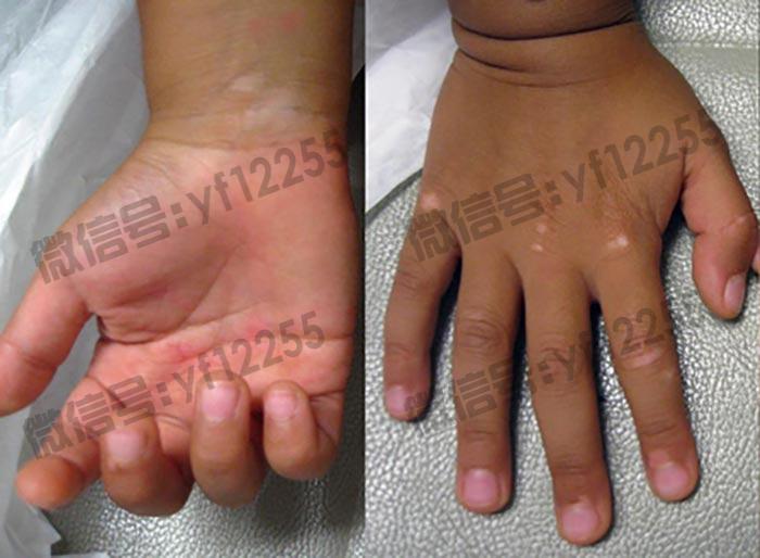 武汉环亚中医白癜风医院